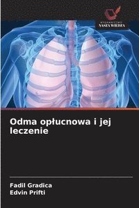 bokomslag Odma oplucnowa i jej leczenie