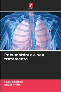 bokomslag Pneumotórax e seu tratamento
