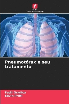bokomslag Pneumotórax e seu tratamento