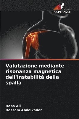bokomslag Valutazione mediante risonanza magnetica dell'instabilità della spalla