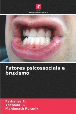 bokomslag Fatores psicossociais e bruxismo