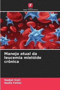 bokomslag Manejo atual da leucemia mielóide crônica