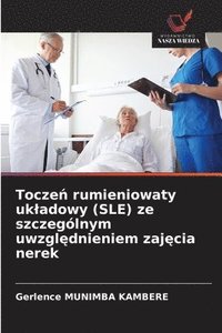 bokomslag Tocze? rumieniowaty ukladowy (SLE) ze szczególnym uwzgl?dnieniem zaj?cia nerek