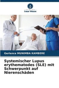 bokomslag Systemischer Lupus erythematodes (SLE) mit Schwerpunkt auf Nierenschäden