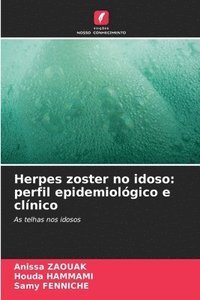 bokomslag Herpes zoster no idoso: perfil epidemiológico e clínico