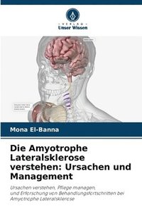 bokomslag Die Amyotrophe Lateralsklerose verstehen: Ursachen und Management