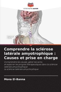 bokomslag Comprendre la sclérose latérale amyotrophique: Causes et prise en charge