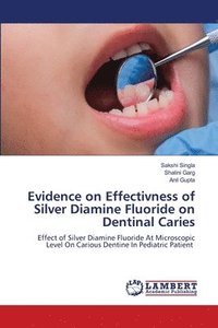 bokomslag Evidence on Effectivness of Silver Diamine Fluoride on Dentinal Caries