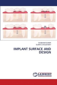 bokomslag Implant Surface and Design