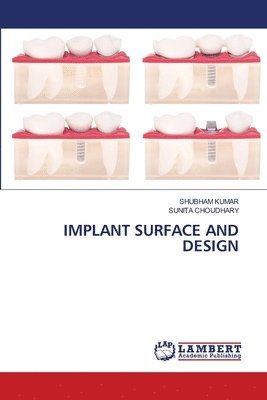 Implant Surface and Design 1