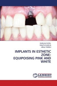 bokomslag Implants in Esthetic Zone