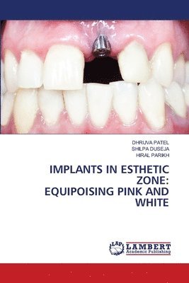 Dhruva Patel, Shilpa Duseja, Hiral Parikh, DHRUVA PATEL - Implants in Esthetic Zone, Häftad