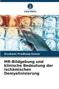 bokomslag MR-Bildgebung und klinische Bedeutung der ischmischen Demyelinisierung