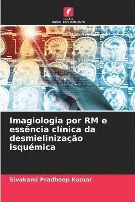 bokomslag Imagiologia por RM e essncia clnica da desmielinizao isqumica