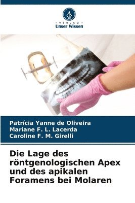 Die Lage des rntgenologischen Apex und des apikalen Foramens bei Molaren 1