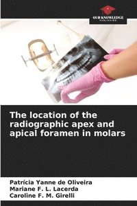 bokomslag The location of the radiographic apex and apical foramen in molars