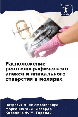 Патрисия де Оливейра, Марианна &#1060. &#1051. &#1051&#1072&#1089&#1077&#1088&#1076&#1072, Каролина &#1060. &#1052. &#1043&#1080&#1088&#1077&#1083&#1083&#1080, &#1076;&#1077; &#1054;&#1083;&#1080;&#10, &#1060. &#1051. &#1051&#1072&#1089&#1077, ¿¿¿¿¿¿¿¿ ¿¿ ¿¿¿¿¿¿¿¿, ¿¿¿¿¿¿¿¿ ¿. ¿. ¿¿¿¿¿¿¿, Patrisiq Yanne de Oliwejra - Расположение рентгенографического апек&#, Häftad