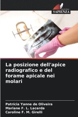 posizione dell'apice radiografico e del forame apicale nei molari