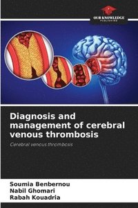 bokomslag Diagnosis and management of cerebral venous thrombosis