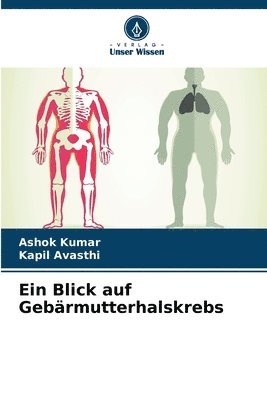 Ashok Kumar, Kapil Avasthi - Blick auf Gebärmutterhalskrebs, Häftad