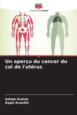 bokomslag aperçu du cancer du col de l'utérus