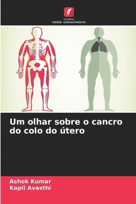bokomslag Um olhar sobre o cancro do colo do útero