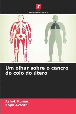 Um olhar sobre o cancro do colo do tero 1