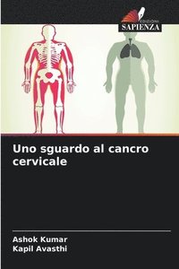 bokomslag Uno sguardo al cancro cervicale