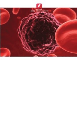 Kamini Kiran, Shailesh Kumar, Manish Kumar - Tumor de células redondas, Häftad