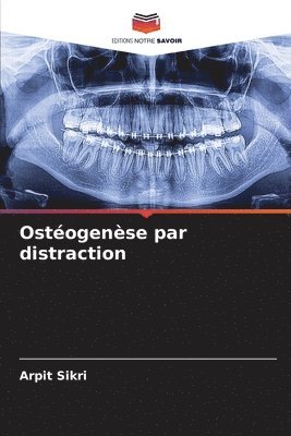 Arpit Sikri - Ostéogenèse par distraction, Häftad