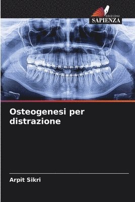 Osteogenesi per distrazione 1