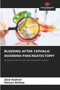 bokomslag Bleeding After Cephalic Duodeno-Pancreatectomy