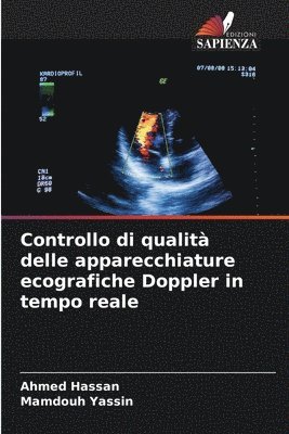 Ahmed Hassan, Mamdouh Yassin - Controllo di qualità delle apparecchiature ecografiche Doppler in tempo reale, Häftad