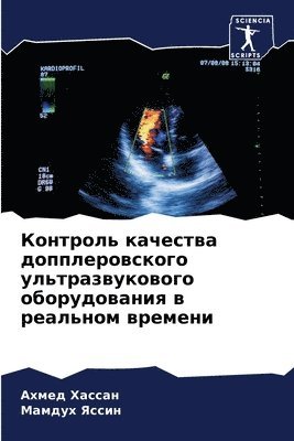 Ахмед Хассан, Мамдух Яссин - Контроль качества допплеровского ультра&, Häftad