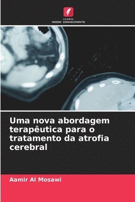 bokomslag Uma nova abordagem teraputica para o tratamento da atrofia cerebral