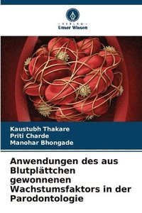 bokomslag Anwendungen des aus Blutplttchen gewonnenen Wachstumsfaktors in der Parodontologie