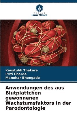bokomslag Anwendungen des aus Blutplättchen gewonnenen Wachstumsfaktors in der Parodontologie