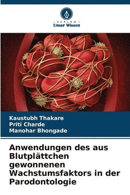 bokomslag Anwendungen des aus Blutplttchen gewonnenen Wachstumsfaktors in der Parodontologie