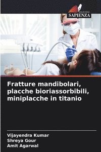 bokomslag Fratture mandibolari, placche bioriassorbibili, miniplacche in titanio