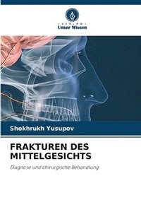 bokomslag Frakturen Des Mittelgesichts