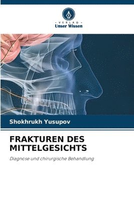 bokomslag Frakturen Des Mittelgesichts