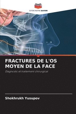 bokomslag Fractures de l'Os Moyen de la Face