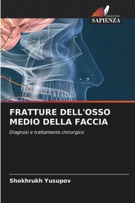 bokomslag Fratture Dell'osso Medio Della Faccia