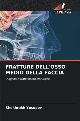 Shokhrukh Yusupov - Fratture Dell'osso Medio Della Faccia, Häftad