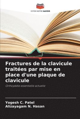 Yogesh C Patel, Alizayagam N Hasan - Fractures de la clavicule traitées par mise en place d'une plaque de clavicule, Häftad