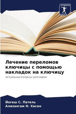 Йогеш &#1057. Патель, Ализаягам &#1053. Хасан, &#1055;&#1072;&#1090;&#1077;&#1083;&#110, &#1 &#1061;&#1072;&#1089;&#1072;&#1085;, ¿¿¿¿¿ ¿. ¿¿¿¿¿¿, ¿¿¿¿¿¿¿¿¿ ¿. ¿¿¿¿¿ - Лечение переломов ключицы с помощью накл&#1072, Häftad