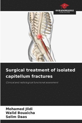 Mohamed Jlidi, Walid Bouaicha, Selim Daas - Surgical treatment of isolated capitellum fractures, Häftad