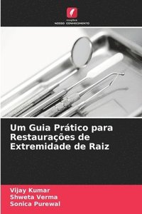 bokomslag Um Guia Prtico para Restauraes de Extremidade de Raiz