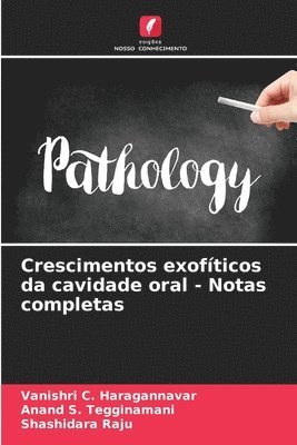 bokomslag Crescimentos exofticos da cavidade oral - Notas completas