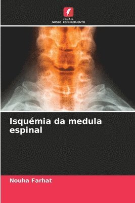 Isquémia da medula espinal